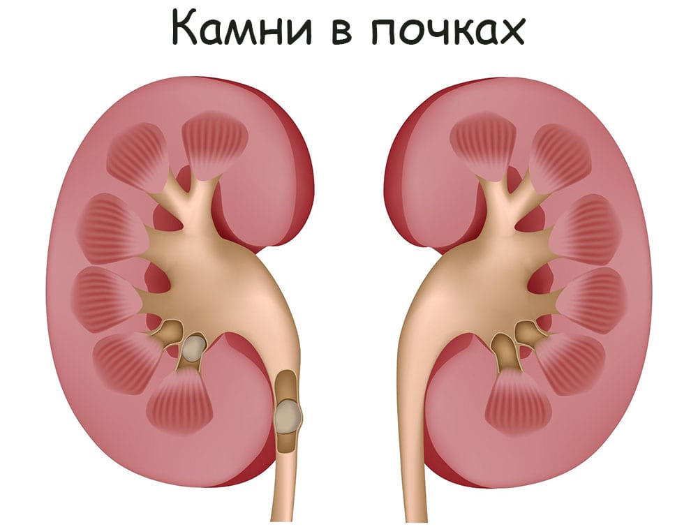 Аккаунты кракен